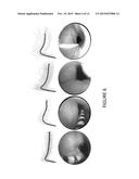 AIRFLOW AND AIRWAY FACTORS diagram and image