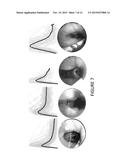 AIRFLOW AND AIRWAY FACTORS diagram and image