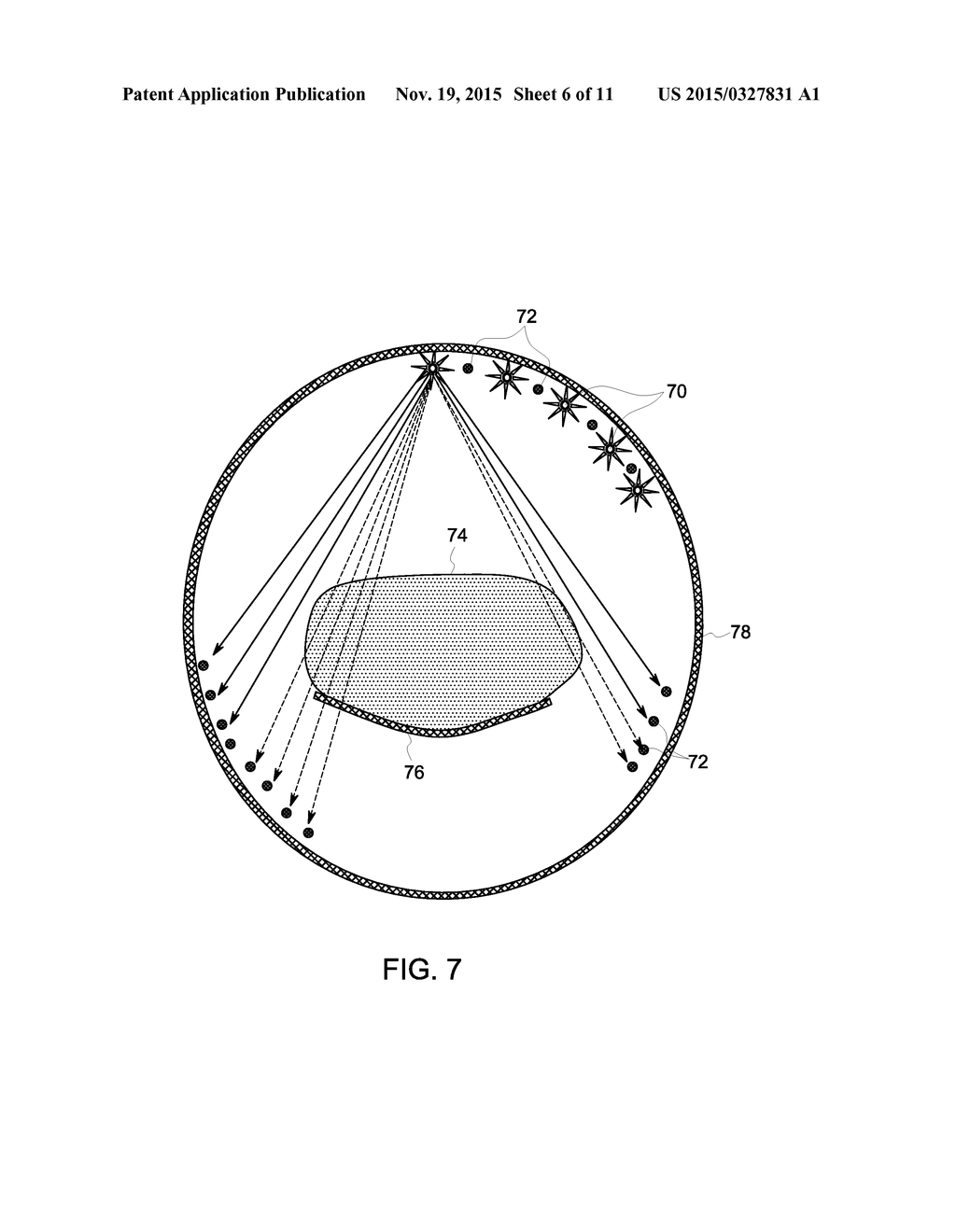 SYSTEM AND METHOD FOR SUBJECT SHAPE ESTIMATION - diagram, schematic, and image 07