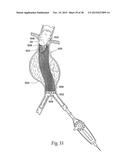 Surgical Fastener Assembly for Attaching a Prosthesis diagram and image