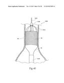 Surgical Fastener Assembly for Attaching a Prosthesis diagram and image