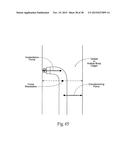 Surgical Fastener Assembly for Attaching a Prosthesis diagram and image