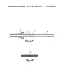 MATERIAL REMOVAL DEVICE AND METHOD OF USE diagram and image