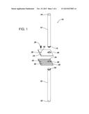 TEMPORARY FRACTURE STABILIZATION DEVICE diagram and image