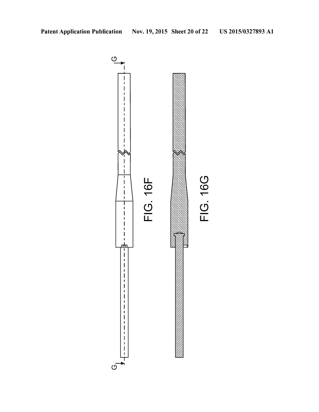 COMPOSITE MATERIAL BONE IMPLANT - diagram, schematic, and image 21