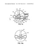 MODULE FOR DRIVING A CATHETERIZATION SYSTEM diagram and image