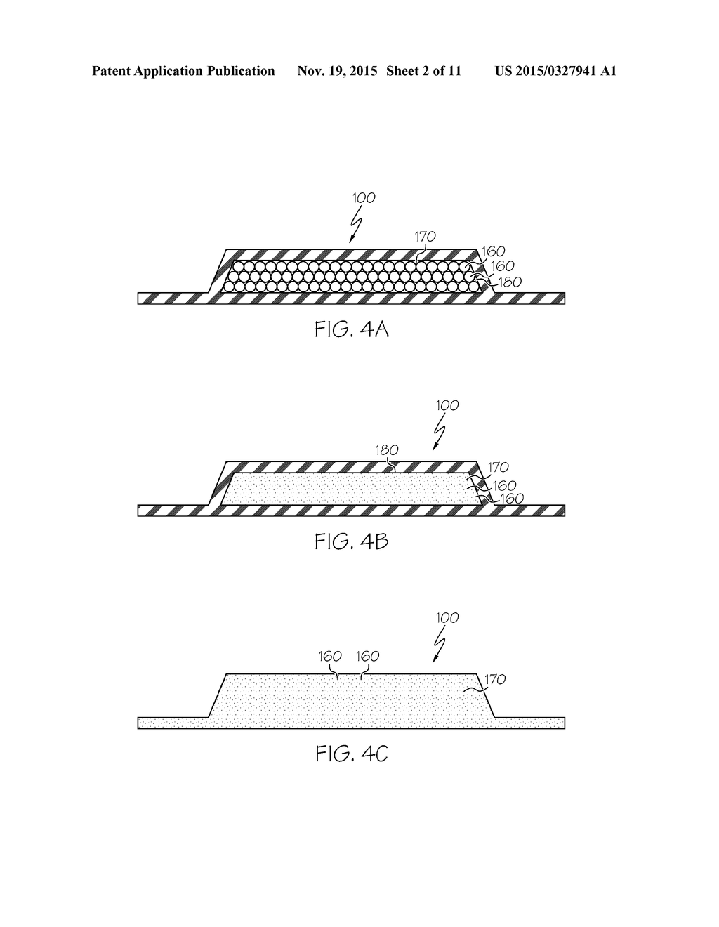 RADIATION SHIELDING IMPLANTS AND METHODS OF USE - diagram, schematic, and image 03