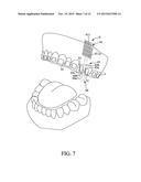 IMPLANT POSITIONING DEVICE FOR AN ORTHODONTIC BRACE diagram and image