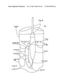 ELECTRICAL DISCHARGE IRRIGATOR APPARATUS AND METHOD diagram and image