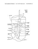 ELECTRICAL DISCHARGE IRRIGATOR APPARATUS AND METHOD diagram and image