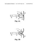 IMPLANTS, TOOLS, AND METHODS FOR TREATMENT OF PELVIC CONDITIONS diagram and image