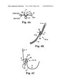 IMPLANTS, TOOLS, AND METHODS FOR TREATMENT OF PELVIC CONDITIONS diagram and image