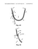 IMPLANTS, TOOLS, AND METHODS FOR TREATMENT OF PELVIC CONDITIONS diagram and image