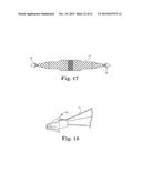 Surgical Needle and Anchor System with Retractable Features diagram and image