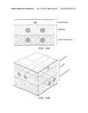 SOFT TISSUE AUGMENTATION THREADS AND METHODS OF USE THEREOF diagram and image