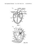 PROSTHETIC HEART VALVE DEVICES AND ASSOCIATED SYSTEMS AND METHODS diagram and image