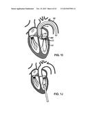 PROSTHETIC HEART VALVE DEVICES AND ASSOCIATED SYSTEMS AND METHODS diagram and image