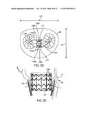 PROSTHETIC HEART VALVE DEVICES AND ASSOCIATED SYSTEMS AND METHODS diagram and image