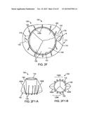 PROSTHETIC HEART VALVE DEVICES AND ASSOCIATED SYSTEMS AND METHODS diagram and image