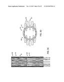 PROSTHETIC HEART VALVE DEVICES AND ASSOCIATED SYSTEMS AND METHODS diagram and image