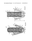 PROSTHETIC HEART VALVE DEVICES AND ASSOCIATED SYSTEMS AND METHODS diagram and image