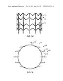 PROSTHETIC HEART VALVE DEVICES AND ASSOCIATED SYSTEMS AND METHODS diagram and image