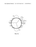 PROSTHETIC HEART VALVE DEVICES AND ASSOCIATED SYSTEMS AND METHODS diagram and image