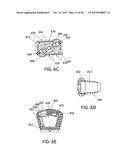 Standalone Interbody Implants diagram and image