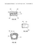 Standalone Interbody Implants diagram and image