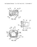 Standalone Interbody Implants diagram and image