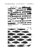 COMPLIANT IMPLANTABLE MEDICAL DEVICES AND METHODS OF MAKING SAME diagram and image