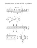 METHOD AND APPARATUS FOR TREATING URETHRAL STRICTURE diagram and image