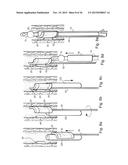 METHOD AND APPARATUS FOR TREATING URETHRAL STRICTURE diagram and image