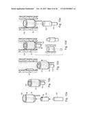 METHOD AND APPARATUS FOR TREATING URETHRAL STRICTURE diagram and image