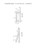 METHOD AND APPARATUS FOR TREATING URETHRAL STRICTURE diagram and image