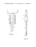 METHOD AND APPARATUS FOR TREATING URETHRAL STRICTURE diagram and image