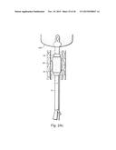 METHOD AND APPARATUS FOR TREATING URETHRAL STRICTURE diagram and image