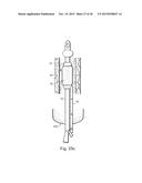 METHOD AND APPARATUS FOR TREATING URETHRAL STRICTURE diagram and image