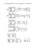 METHOD AND APPARATUS FOR TREATING URETHRAL STRICTURE diagram and image