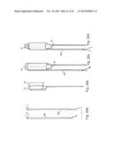 METHOD AND APPARATUS FOR TREATING URETHRAL STRICTURE diagram and image