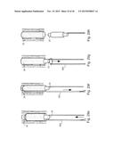 METHOD AND APPARATUS FOR TREATING URETHRAL STRICTURE diagram and image