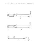 METHOD AND APPARATUS FOR TREATING URETHRAL STRICTURE diagram and image