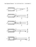 METHOD AND APPARATUS FOR TREATING URETHRAL STRICTURE diagram and image