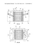 ORTHOPEDIC DEVICE FOR TREATING COMPLICATIONS OF THE HIP diagram and image