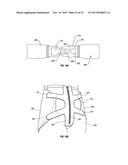 ORTHOPEDIC DEVICE FOR TREATING COMPLICATIONS OF THE HIP diagram and image