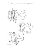 ORTHOPEDIC DEVICE FOR TREATING COMPLICATIONS OF THE HIP diagram and image