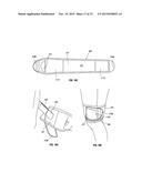 ORTHOPEDIC DEVICE FOR TREATING COMPLICATIONS OF THE HIP diagram and image