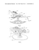 ORTHOPEDIC DEVICE FOR TREATING COMPLICATIONS OF THE HIP diagram and image