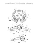 ORTHOPEDIC DEVICE FOR TREATING COMPLICATIONS OF THE HIP diagram and image