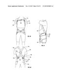 ORTHOPEDIC DEVICE FOR TREATING COMPLICATIONS OF THE HIP diagram and image